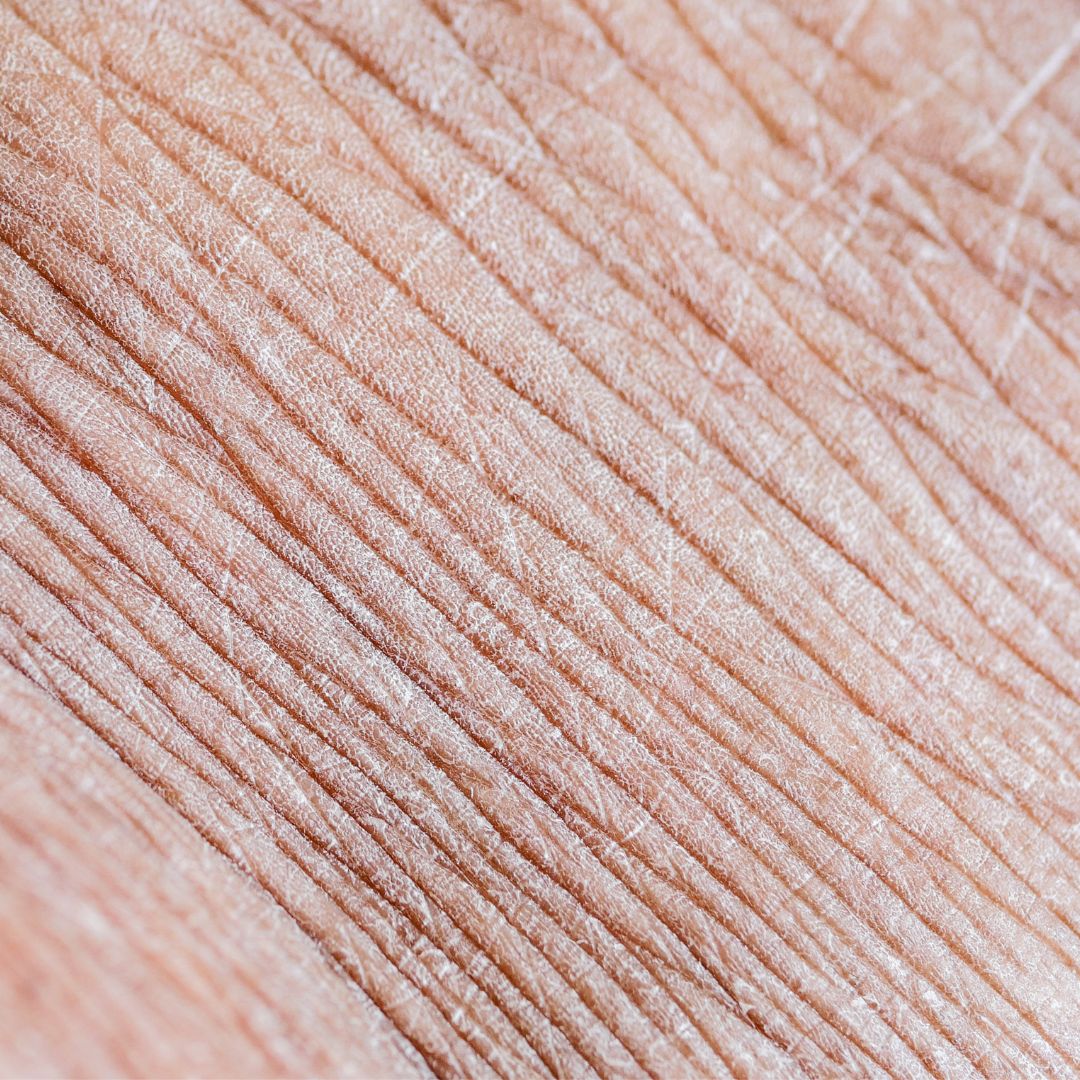 Hautpflege gegen Anti-Aging und Hautalterung