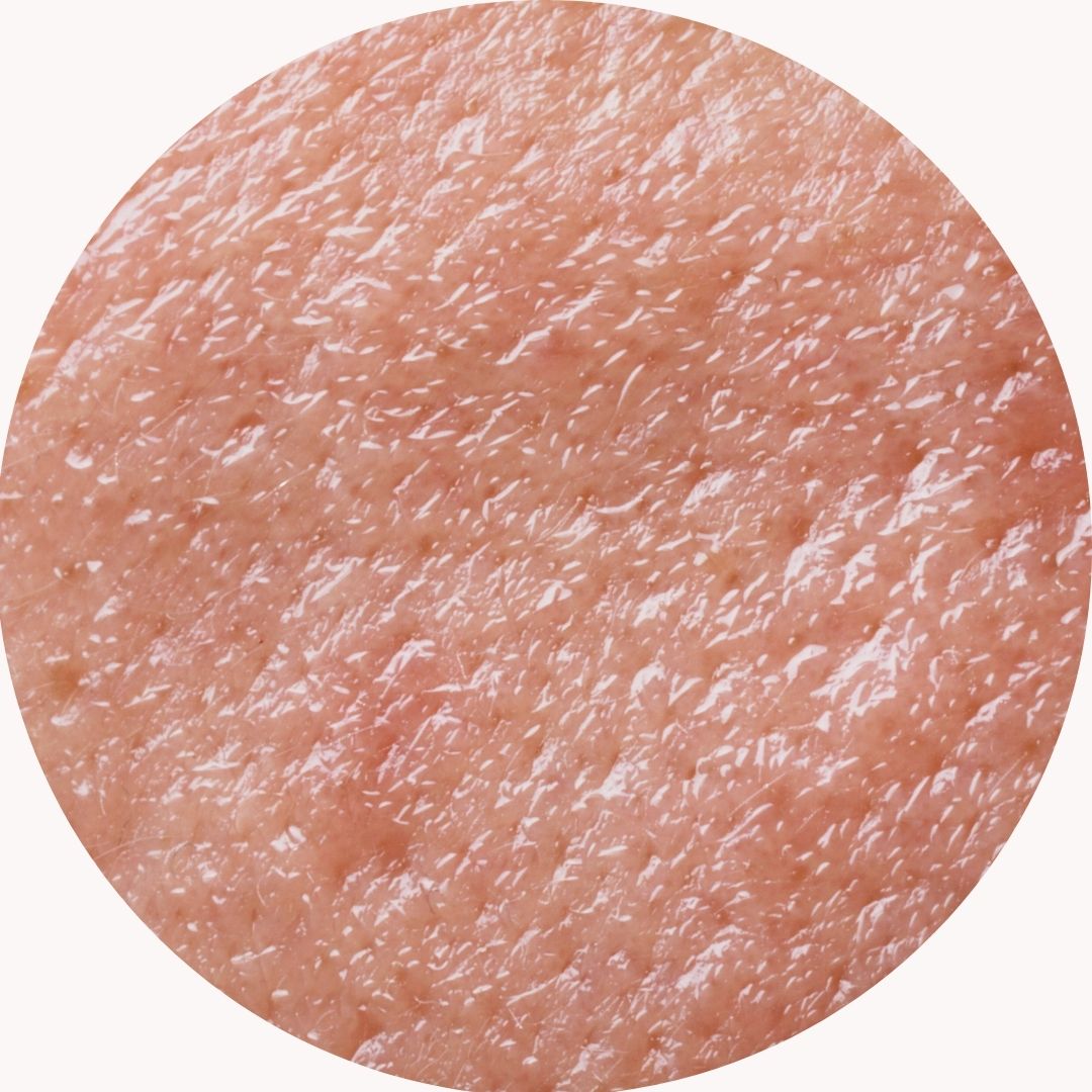 Hautpflege für ölige Haut